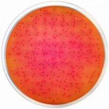 Агар с бриллиантовым зелёным модифицированный (ISO 6579, ISO 19250) Conda 500 г 1143