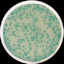 Основа агару хромогенна MRSA Conda 500 г 1423