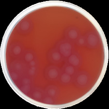 Основа агара селективная Bacillus Cereus (MYP) Conda 500 г 1343