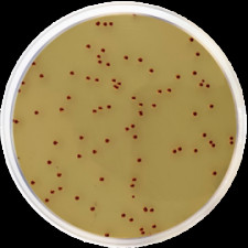 Среда Сланеца-Бартли с добавлением ТТК Conda 500 г 1435