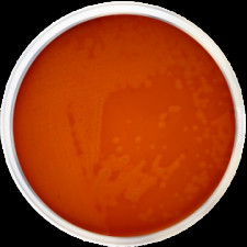 Основа кровяного агара + налидиксовая кислота Conda 500 г 1128