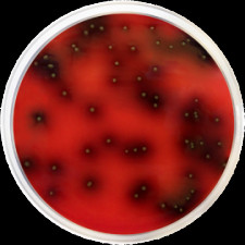 Основание листериозного агара Palcam Conda 500 г 1141